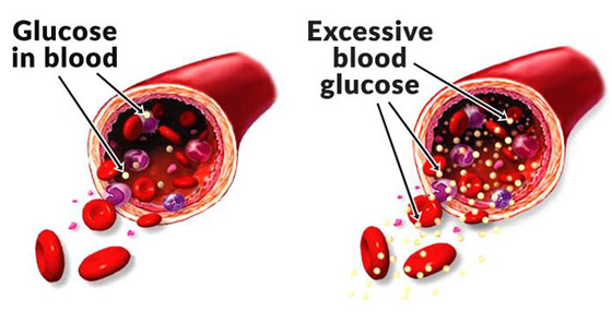 لمرضى السكري.. أطعمة مفيدة تخفض السكر بالدم صورة رقم 22