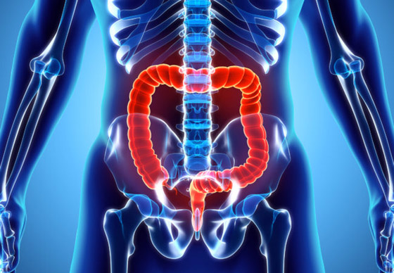 كيف تعرف أنك مصاب بسرطان القولون؟.. وأعراض شائعة لا تصدقها! صورة رقم 5