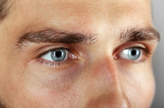 إليك كل شيء تريد معرفته عن انتفاخات أسفل العين وأسبابها وطرق علاجها صورة رقم 3