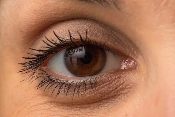 إليك كل شيء تريد معرفته عن انتفاخات أسفل العين وأسبابها وطرق علاجها صورة رقم 4