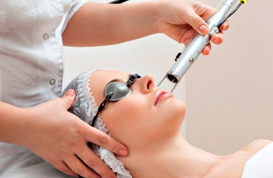 التقشير واللايزر لإزالة التجاعيد في عيادة التجميل صورة رقم 3