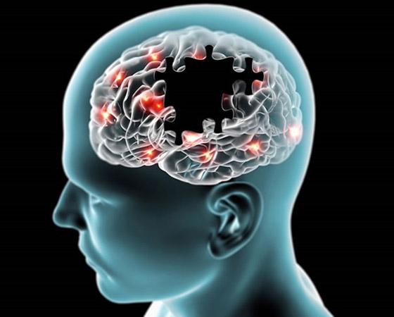 دراسة: بروتين طبيعي في أدمغتنا يحمينا من مرض ألزهايمر! صورة رقم 4