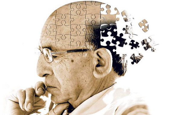 دراسة: بروتين طبيعي في أدمغتنا يحمينا من مرض ألزهايمر! صورة رقم 5