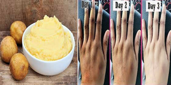 كنوز الشتاء تعتني بالبشرة والشعر على طريقتها صورة رقم 4