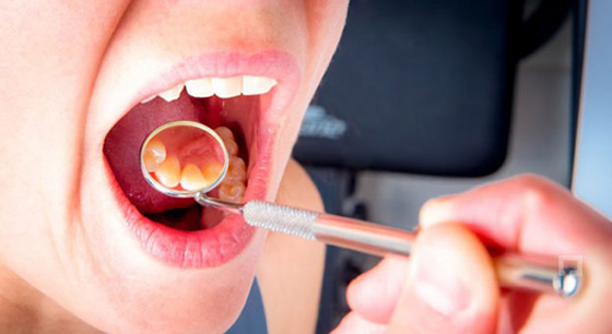 احذروا.. ربما تفقدون أسنانكم بسبب التهاب اللثة!! صورة رقم 4