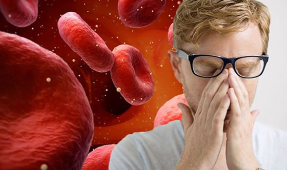 نقص الحديد في الجسم.. أسبابه وأعراضه وطرق علاجه صورة رقم 4