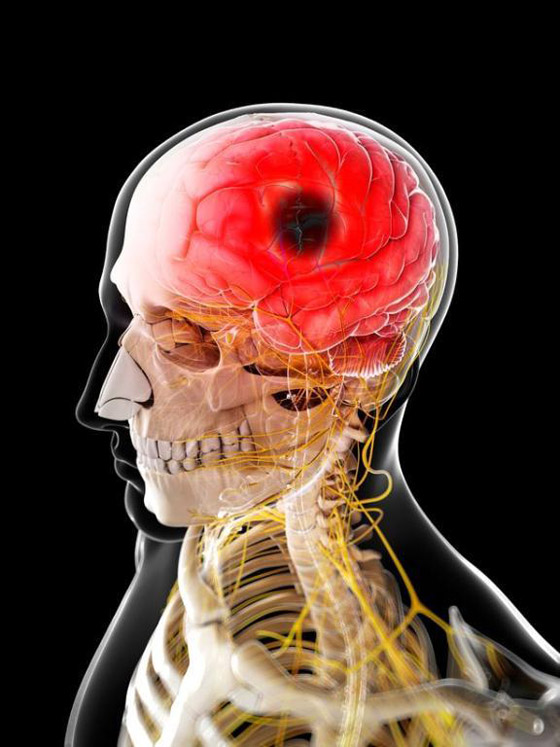 دراسة علمية: النوم لأكثر من تسع ساعات يُعرضك للسكتة الدماغية صورة رقم 2