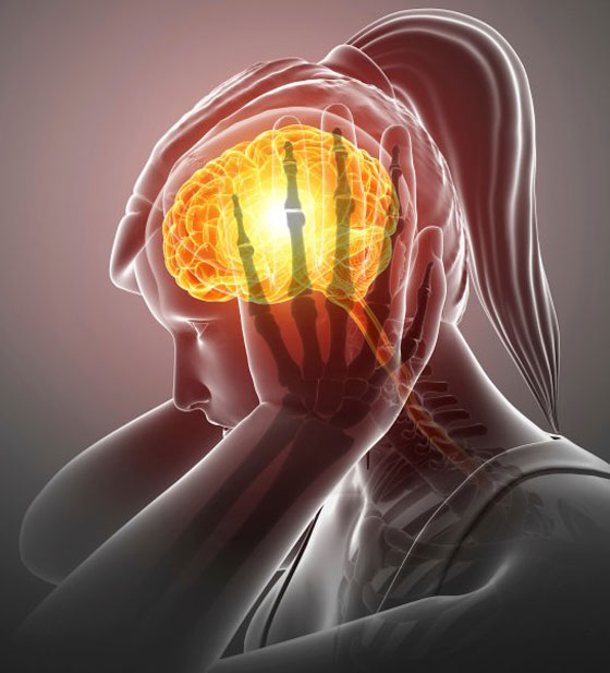 لمن يعانون صداعاً نصفياً.. هذا قد يكون السبب صورة رقم 8 لمن يعانون صداعاً نصفياً.. هذا قد يكون السبب صورة رقم 8