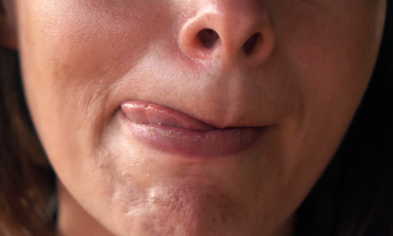 لهذا السبب.. لا تلعق شفاهك في فصل الشتاء البارد! صورة رقم 1