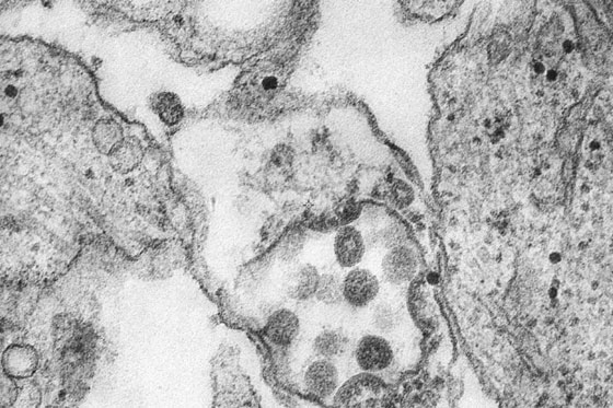 وفاة الطبيب الصيني الذي حذر من فيروس كورونا وهددته الشرطة ليصمت! صورة رقم 50