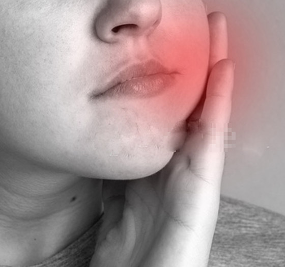 تورم الخد.. ما هي أسبابه، أعراضه، وكيف يمكن التعامل معه وعلاجه؟ صورة رقم 11