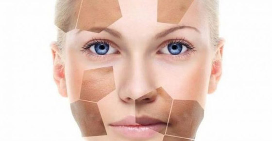 هذه الحلول تعتبر الأفضل لتوحيد البشرة وإزالة البقع صورة رقم 2