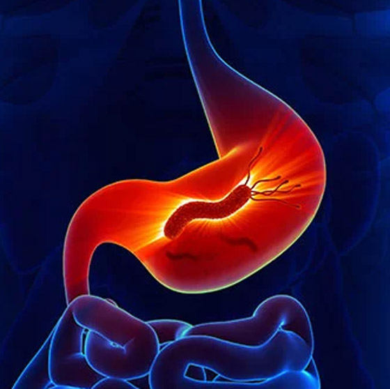 هل جرثومة المعدة قاتلة؟ تعرف على عوارضها وكيفية التخلص منها نهائيا صورة رقم 8 هل جرثومة المعدة قاتلة؟ تعرف على عوارضها وكيفية التخلص منها نهائيا صورة رقم 8