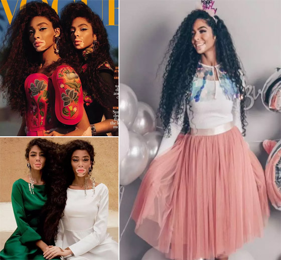 بالصور: عارضات أزياء استثنائيات كسرن صور الجمال النمطية! صورة رقم 3 بالصور: عارضات أزياء استثنائيات كسرن صور الجمال النمطية! صورة رقم 3