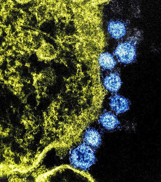 روسيا تبدأ اختبار أول لقاح ضد فيروس كورونا القاتل على الحيوانات صورة رقم 19 روسيا تبدأ اختبار أول لقاح ضد فيروس كورونا القاتل على الحيوانات صورة رقم 19