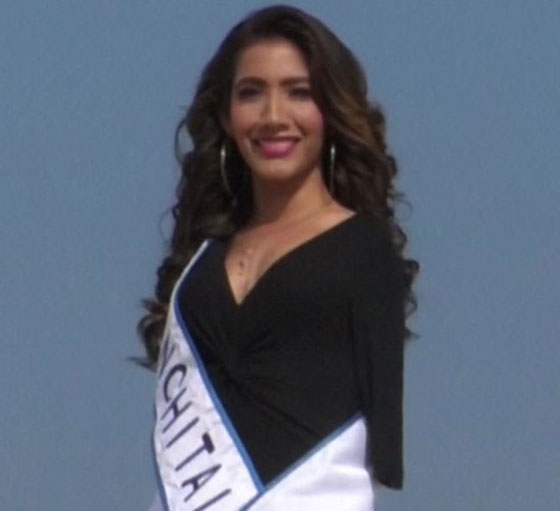 عارضة أزياء بلا ذراعين تتحدى مفاهيم الجمال صورة رقم 6