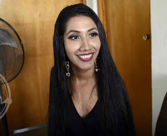 عارضة أزياء بلا ذراعين تتحدى مفاهيم الجمال صورة رقم 9