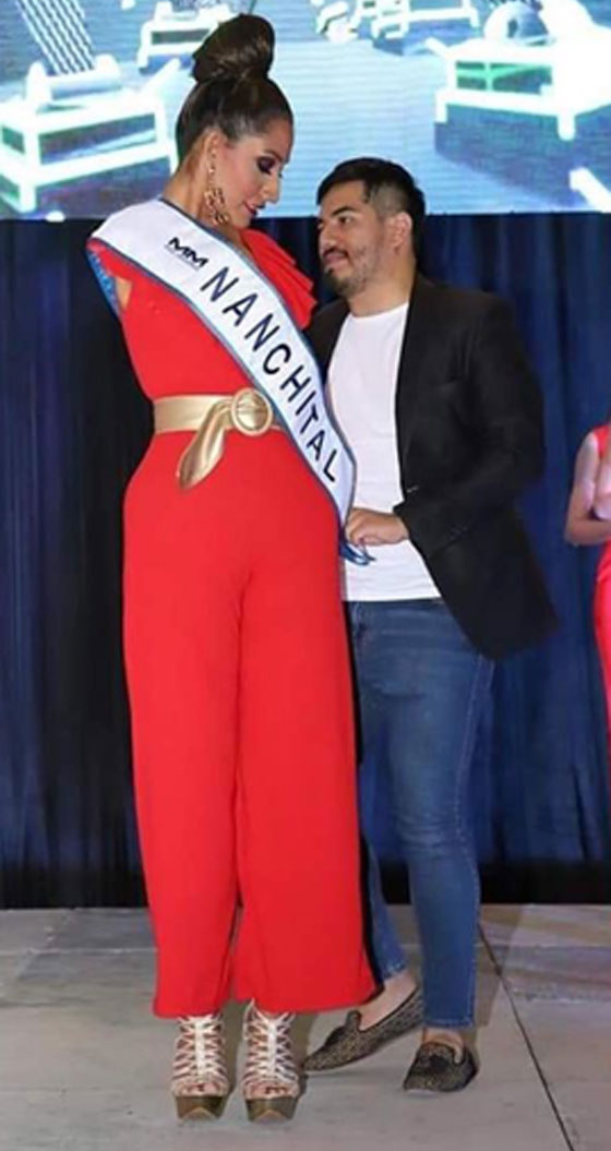 عارضة أزياء بلا ذراعين تتحدى مفاهيم الجمال صورة رقم 4