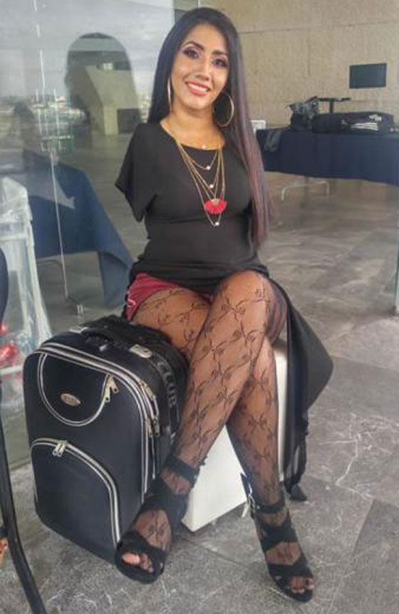 عارضة أزياء بلا ذراعين تتحدى مفاهيم الجمال صورة رقم 13