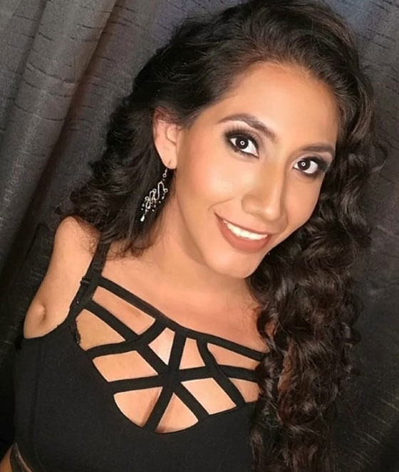 عارضة أزياء بلا ذراعين تتحدى مفاهيم الجمال صورة رقم 1