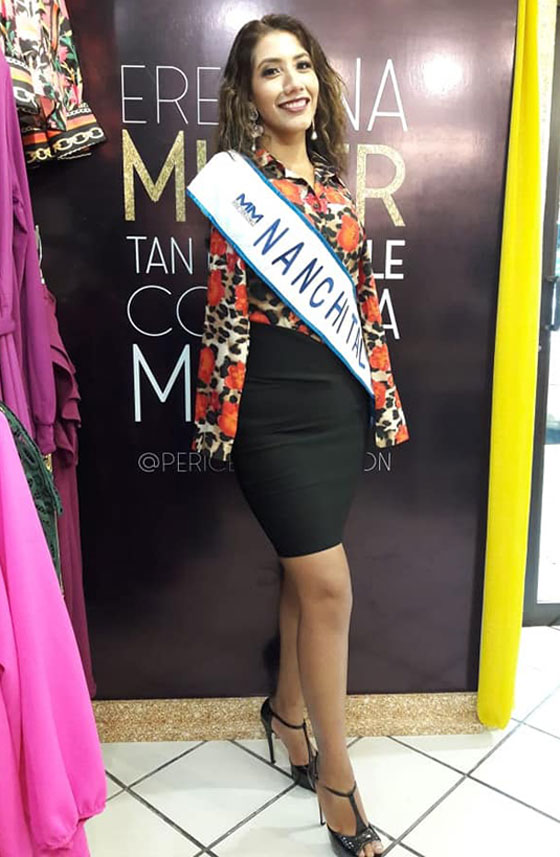 عارضة أزياء بلا ذراعين تتحدى مفاهيم الجمال صورة رقم 14