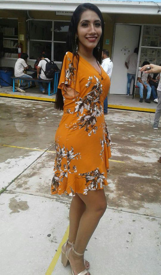 عارضة أزياء بلا ذراعين تتحدى مفاهيم الجمال صورة رقم 15