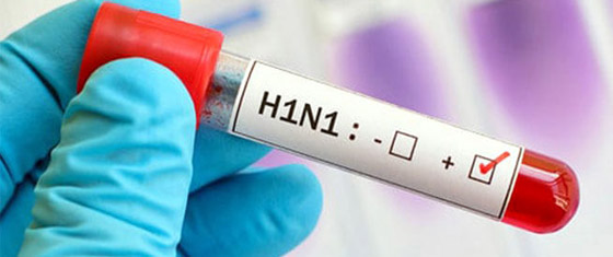 أخطر 5 أوبئة عرفها العالم في العقد الماضي صورة رقم 2 أخطر 5 أوبئة عرفها العالم في العقد الماضي صورة رقم 2