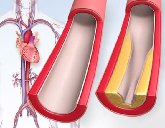 أبرز الخرافات والشائعات المنتشرة عن الكوليسترول التي يصدقها الكثيرون صورة رقم 9 أبرز الخرافات والشائعات المنتشرة عن الكوليسترول التي يصدقها الكثيرون صورة رقم 9