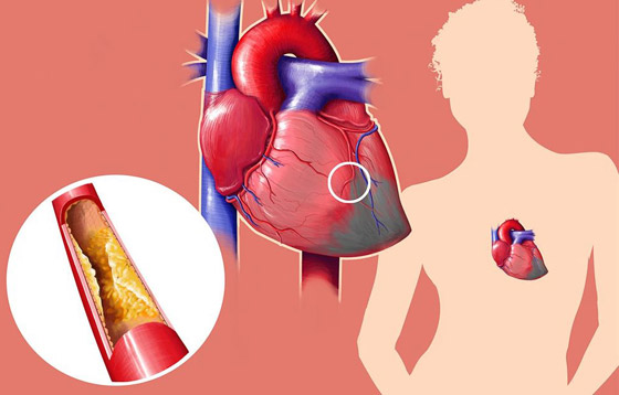 أبرز الخرافات والشائعات المنتشرة عن الكوليسترول التي يصدقها الكثيرون صورة رقم 8 أبرز الخرافات والشائعات المنتشرة عن الكوليسترول التي يصدقها الكثيرون صورة رقم 8