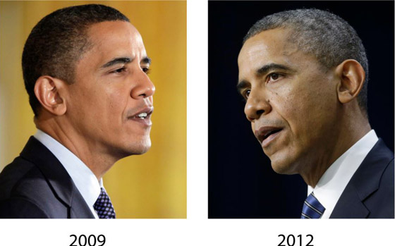 لماذا يشيب الشعر ويتحول لونه للرمادي أو الأبيض في سن مبكرة؟ صورة رقم 4 لماذا يشيب الشعر ويتحول لونه للرمادي أو الأبيض في سن مبكرة؟ صورة رقم 4