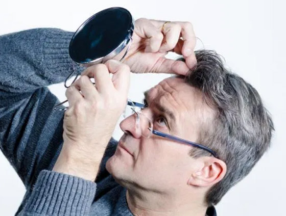 لماذا يشيب الشعر ويتحول لونه للرمادي أو الأبيض في سن مبكرة؟ صورة رقم 3 لماذا يشيب الشعر ويتحول لونه للرمادي أو الأبيض في سن مبكرة؟ صورة رقم 3