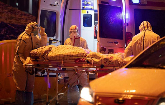 كيف يهاجم فيروس كورونا الجديد جسم الإنسان؟ صورة رقم 25