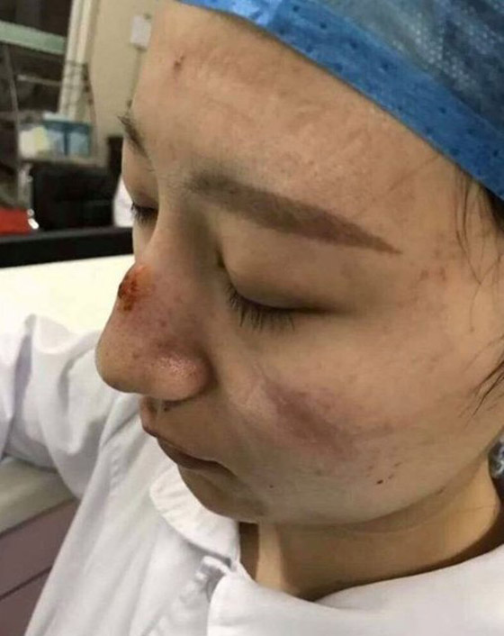 مشاهد مؤثرة لأطباء صينيين.. هيستيريا وانهيارات عصبية وأيام بلا نوم! صورة رقم 6 مشاهد مؤثرة لأطباء صينيين.. هيستيريا وانهيارات عصبية وأيام بلا نوم! صورة رقم 6