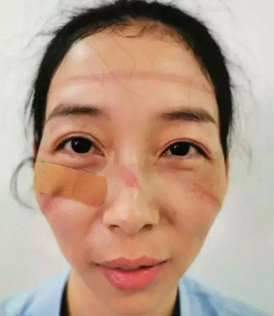 مشاهد مؤثرة لأطباء صينيين.. هيستيريا وانهيارات عصبية وأيام بلا نوم! صورة رقم 5 مشاهد مؤثرة لأطباء صينيين.. هيستيريا وانهيارات عصبية وأيام بلا نوم! صورة رقم 5