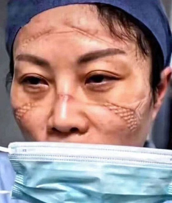 مشاهد مؤثرة لأطباء صينيين.. هيستيريا وانهيارات عصبية وأيام بلا نوم! صورة رقم 8 مشاهد مؤثرة لأطباء صينيين.. هيستيريا وانهيارات عصبية وأيام بلا نوم! صورة رقم 8