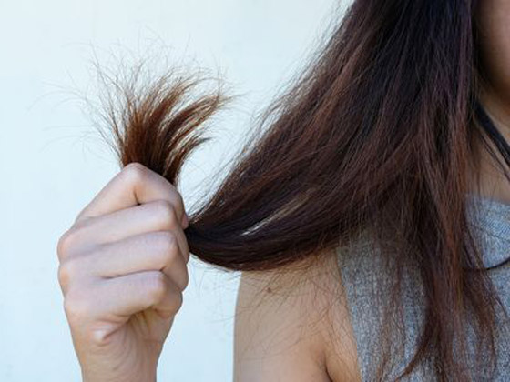 جفاف الشعر.. 5 علاجات منزلية سريعة وسهلة صورة رقم 3