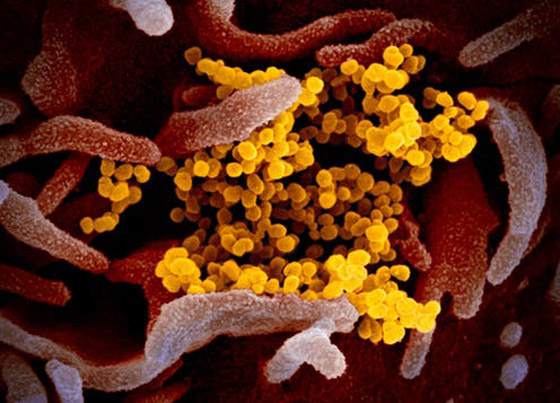 فيروس كورونا.. الخريطة المفصلة للدول وللضحايا صورة رقم 7