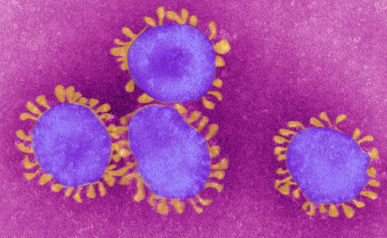 فيروس كورونا ينتشر بـ12 بلدا عربيا.. إليكم القائمة وعدد حالات الإصابة صورة رقم 6