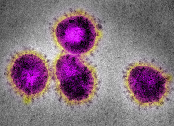 ما الذي يخبئه المستقبل لفيروس كورونا؟ هكذا انتهت 3 أمراض معدية أخرى صورة رقم 5 ما الذي يخبئه المستقبل لفيروس كورونا؟ هكذا انتهت 3 أمراض معدية أخرى صورة رقم 5