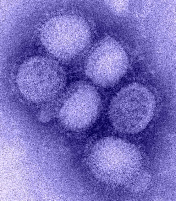 ما الذي يخبئه المستقبل لفيروس كورونا؟ هكذا انتهت 3 أمراض معدية أخرى صورة رقم 4 ما الذي يخبئه المستقبل لفيروس كورونا؟ هكذا انتهت 3 أمراض معدية أخرى صورة رقم 4