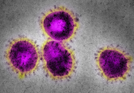 عند إصابتك بأعراض كورونا.. خطوات لتطبيق الحجر الصحي في البيت صورة رقم 7