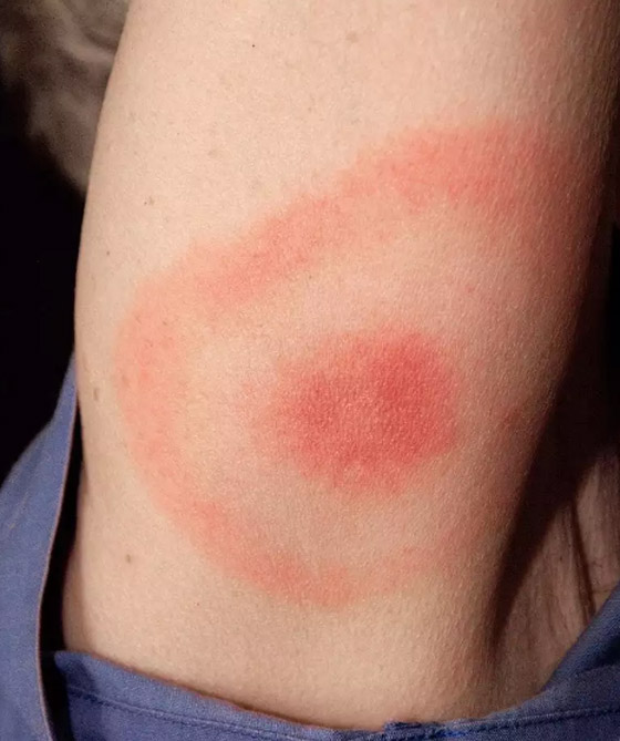 10 أمراض خفية تتنكر في صورة أزمات صحية أخرى صورة رقم 1 10 أمراض خفية تتنكر في صورة أزمات صحية أخرى صورة رقم 1