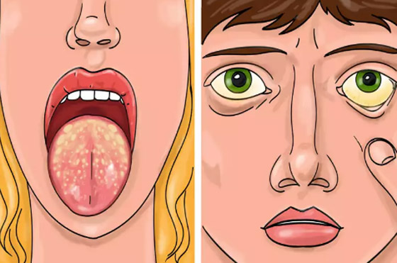 10 أمراض خفية تتنكر في صورة أزمات صحية أخرى صورة رقم 10 10 أمراض خفية تتنكر في صورة أزمات صحية أخرى صورة رقم 10