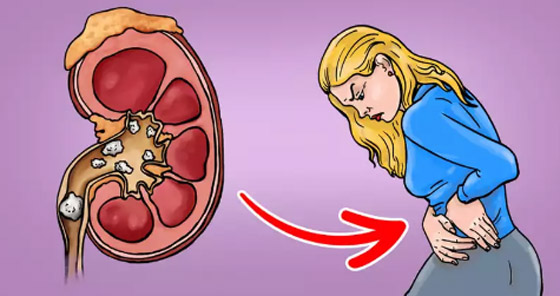 10 أمراض خفية تتنكر في صورة أزمات صحية أخرى صورة رقم 2 10 أمراض خفية تتنكر في صورة أزمات صحية أخرى صورة رقم 2