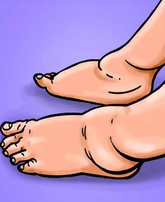 10 أمراض خفية تتنكر في صورة أزمات صحية أخرى صورة رقم 3 10 أمراض خفية تتنكر في صورة أزمات صحية أخرى صورة رقم 3