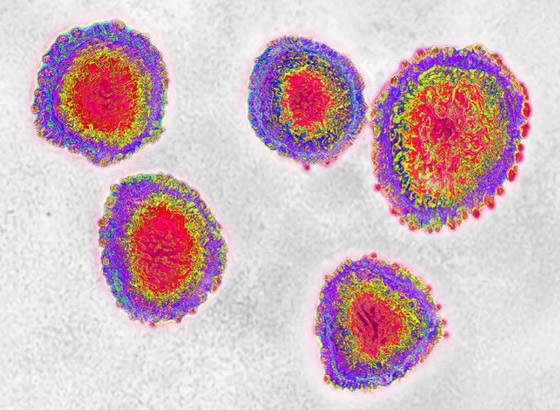 الكشف عن تاريخ أول إصابة بفيروس كورونا صورة رقم 5