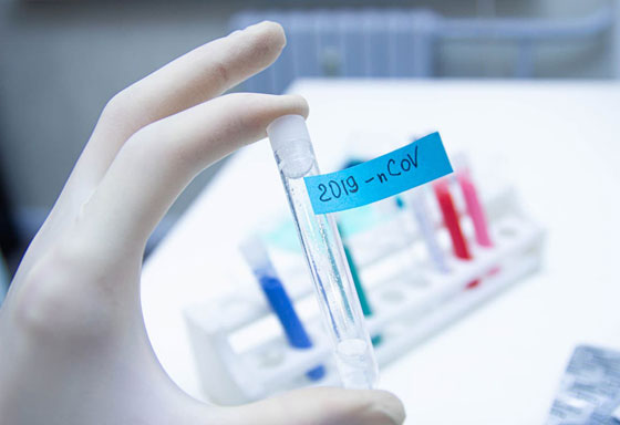 الآثار الوخيمة التي يخلفها فيروس كورونا في جسم الإنسان حتى بعد الشفاء منه! صورة رقم 5 الآثار الوخيمة التي يخلفها فيروس كورونا في جسم الإنسان حتى بعد الشفاء منه! صورة رقم 5