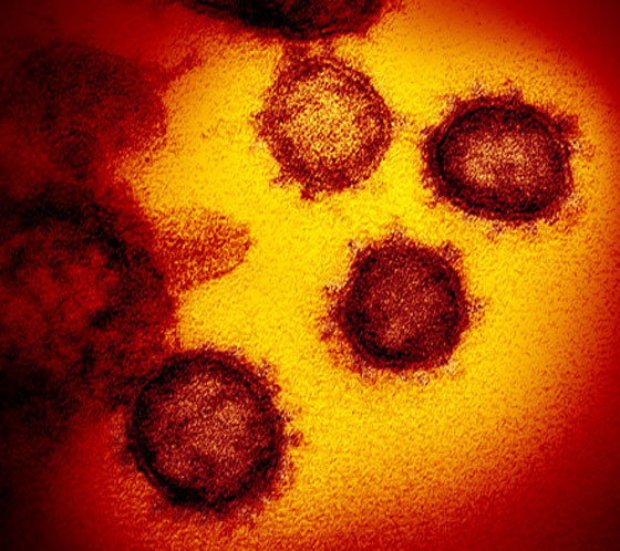 الآثار الوخيمة التي يخلفها فيروس كورونا في جسم الإنسان حتى بعد الشفاء منه! صورة رقم 12 الآثار الوخيمة التي يخلفها فيروس كورونا في جسم الإنسان حتى بعد الشفاء منه! صورة رقم 12