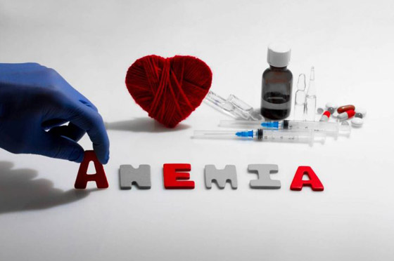 فقر الدم.. تعرفوا إلى طرق الوقاية والعلاج صورة رقم 4 فقر الدم.. تعرفوا إلى طرق الوقاية والعلاج صورة رقم 4