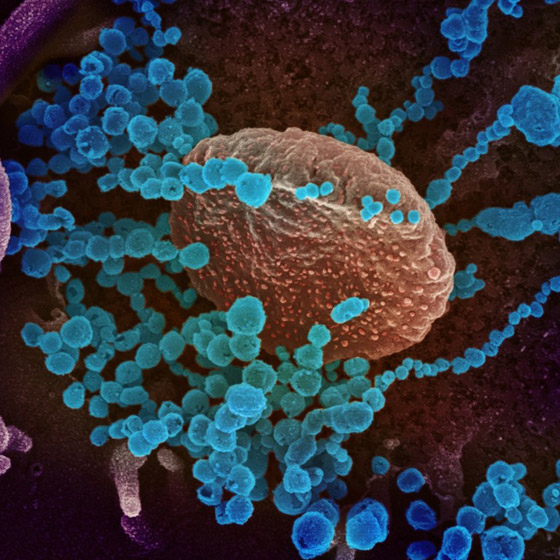 الأصعب لم يأت بعد.. فيروس كورونا يؤرق العالم ويستكين في الصين! صورة رقم 15 الأصعب لم يأت بعد.. فيروس كورونا يؤرق العالم ويستكين في الصين! صورة رقم 15